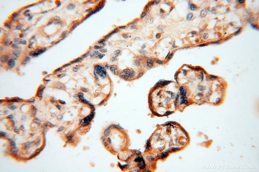 [17581-1-AP-150UL] HRASLS5 Polyclonal antibody