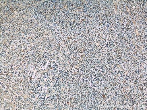 [17583-1-AP-150UL] KIR3DX1 Polyclonal antibody