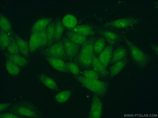 [17584-1-AP-20UL] BXDC1 Polyclonal antibody