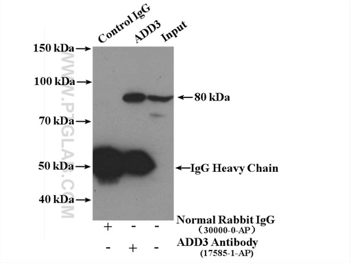 [17585-1-AP-150UL] Gamma Adducin Polyclonal antibody