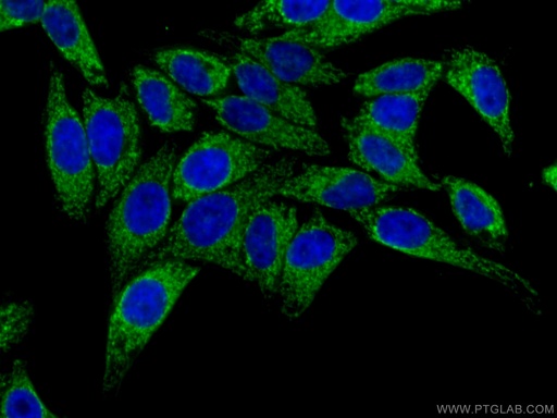[17589-1-AP-20UL] ATP5H Polyclonal antibody