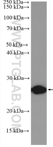 [17590-1-AP-20UL] TNF Alpha Polyclonal antibody