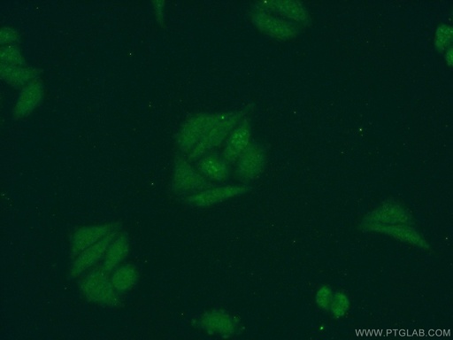 [17591-1-AP-150UL] DDX43 Polyclonal antibody