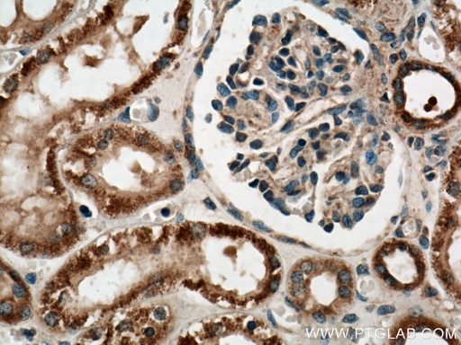 [17592-1-AP-150UL] PYK2 Polyclonal antibody