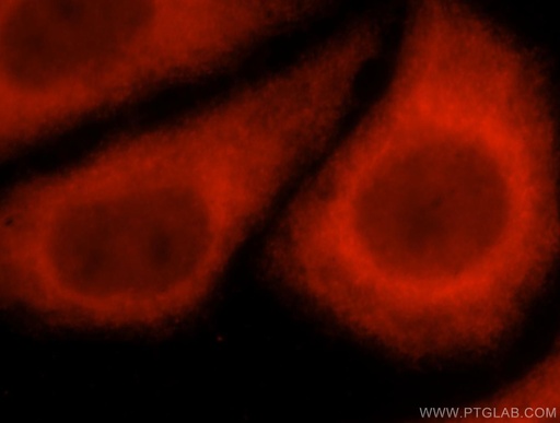 [17593-1-AP-150UL] EXOC5 Polyclonal antibody
