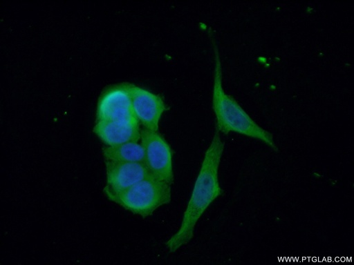 [17597-1-AP-20UL] CDAN1 Polyclonal antibody