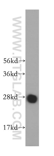 [17598-1-AP-150UL] MED20 Polyclonal antibody