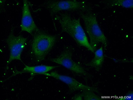 [17603-1-AP-150UL] RSPH3 Polyclonal antibody