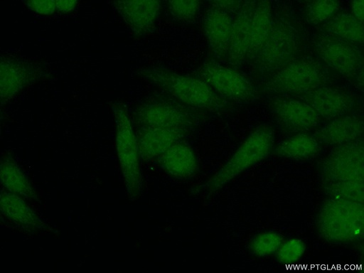 [17604-1-AP-150UL] FIGNL1 Polyclonal antibody