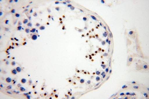 [17616-1-AP-150UL] HEMGN Polyclonal antibody