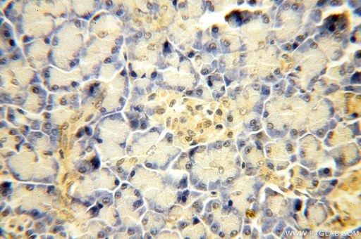 [17618-1-AP-150UL] SBDS Polyclonal antibody