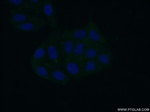 [17619-1-AP-20UL] RPL26 Polyclonal antibody