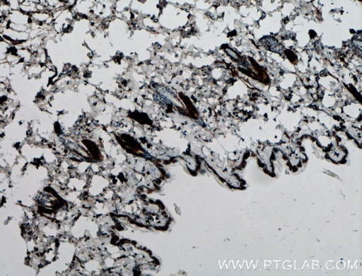 [17625-1-AP-150UL] IL-21 Polyclonal antibody