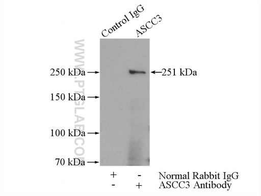 [17627-1-AP-150UL] ASCC3 Polyclonal antibody