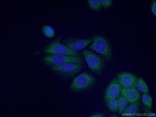 [17628-1-AP-150UL] PRMT3 Polyclonal antibody
