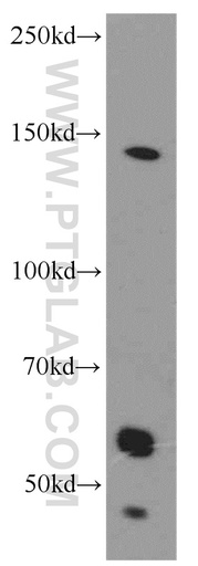 [17634-1-AP-20UL] CDON Polyclonal antibody