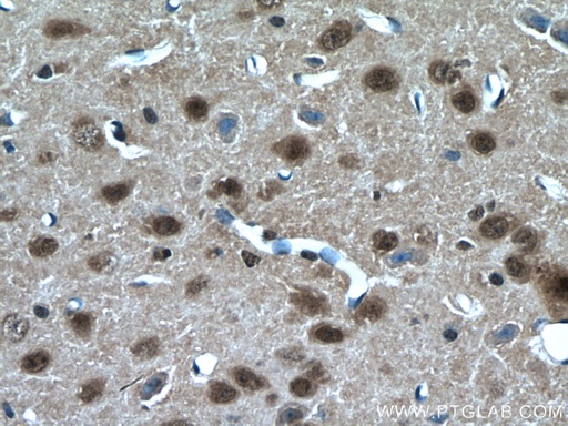 [17635-1-AP-150UL] RORB Polyclonal antibody
