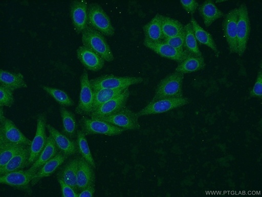 [17637-1-AP-150UL] EHBP1 Polyclonal antibody