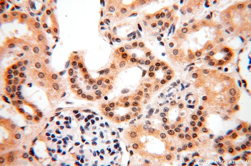 [17639-1-AP-150UL] PGBD3 Polyclonal antibody