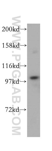 [17642-1-AP-150UL] C7 Polyclonal antibody
