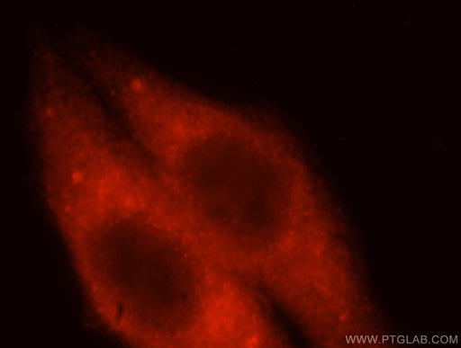 [17643-1-AP-150UL] HMGCS1 Polyclonal antibody