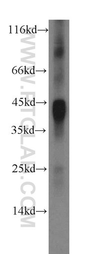 [17645-1-AP-150UL] IL-12B Polyclonal antibody