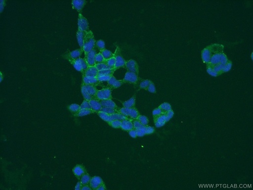 [17650-1-AP-150UL] PAAF1 Polyclonal antibody