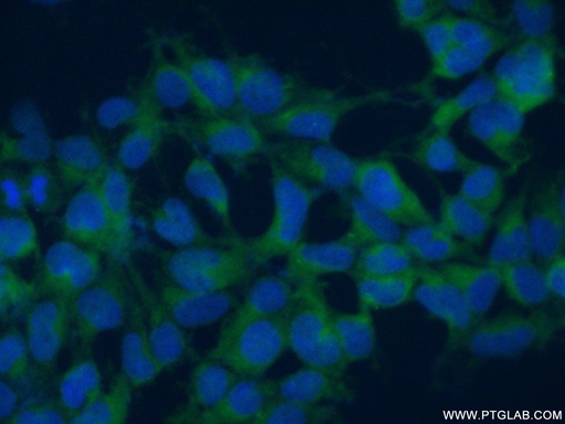 [17656-1-AP-150UL] RANBP6 Polyclonal antibody