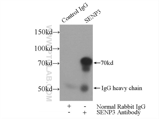 [17659-1-AP-150UL] SENP3 Polyclonal antibody