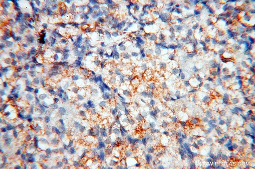 [17661-1-AP-20UL] MFAP4 Polyclonal antibody