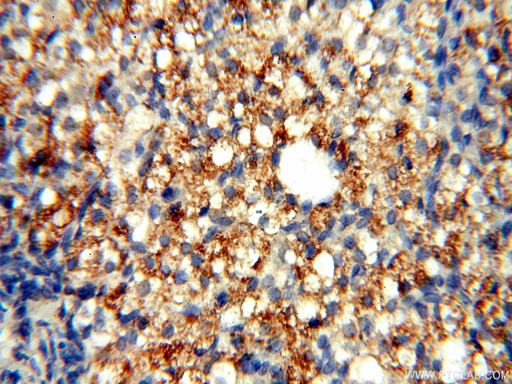 [17665-1-AP-150UL] TYW1B Polyclonal antibody