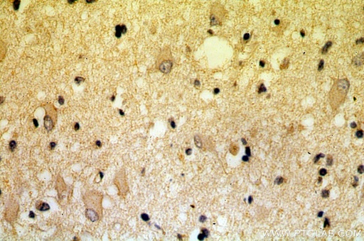 [17668-1-AP-20UL] KLC2 Polyclonal antibody