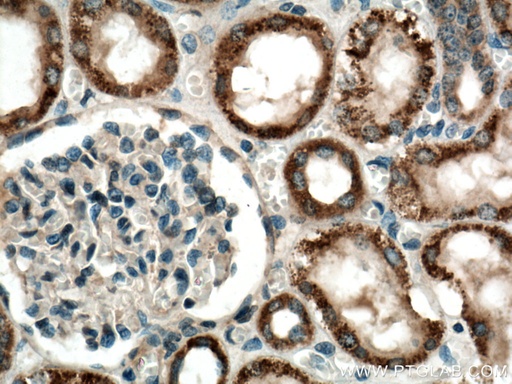 [17670-1-AP-20UL] JAK2 Polyclonal antibody