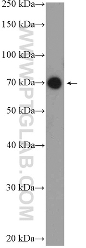 [17671-1-AP-20UL] UTP6 Polyclonal antibody