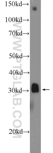 [17678-1-AP-20UL] MSX1 Polyclonal antibody
