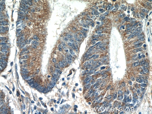 [17679-1-AP-20UL] MRPL55 Polyclonal antibody