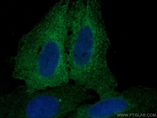 [17682-1-AP-20UL] AHNAK2 Polyclonal antibody