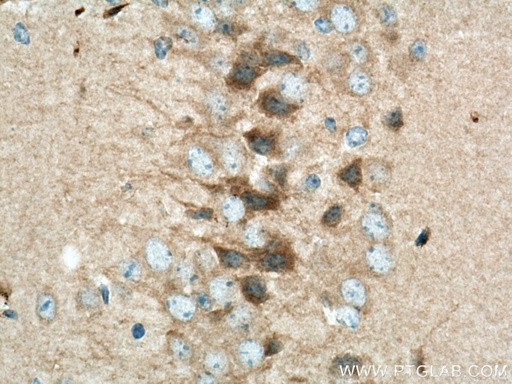 [17684-1-AP-150UL] VEZT Polyclonal antibody