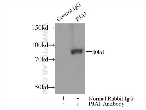 [17687-1-AP-150UL] PJA1 Polyclonal antibody