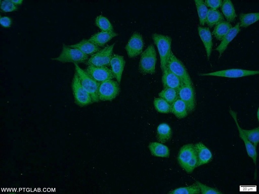 [17691-1-AP-150UL] SH3BP4 Polyclonal antibody