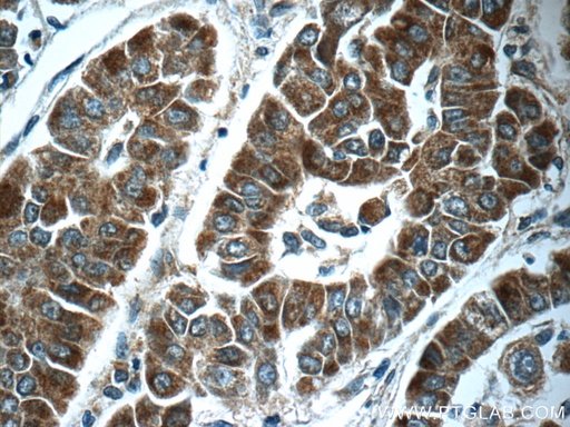[17693-1-AP-20UL] ABL2 Polyclonal antibody