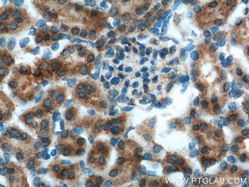 [17695-1-AP-20UL] OCRL Polyclonal antibody