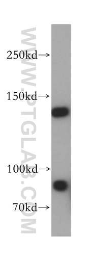 [17697-1-AP-150UL] MAN2B2 Polyclonal antibody
