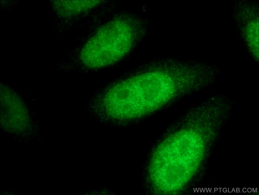 [17701-1-AP-20UL] CDCA2 Polyclonal antibody