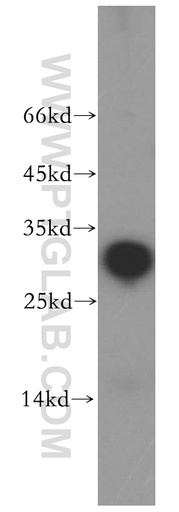 [17704-1-AP-20UL] NRIP2 Polyclonal antibody
