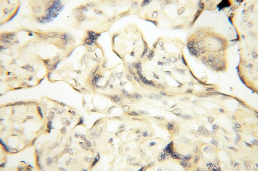 [17705-1-AP-20UL] PM20D2 Polyclonal antibody