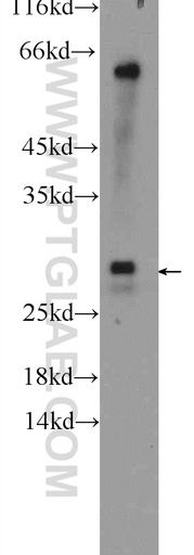 [17713-1-AP-20UL] UBE2J2 Polyclonal antibody