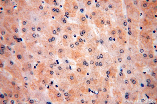 [17715-1-AP-20UL] ULBP1 Polyclonal antibody