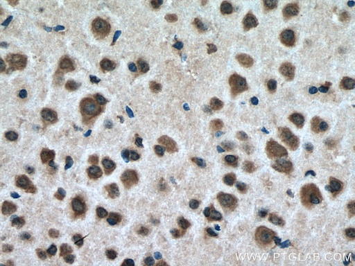 [17716-1-AP-20UL] USMG5 Polyclonal antibody
