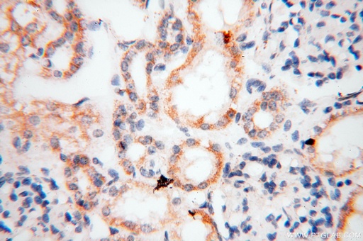 [17717-1-AP-150UL] EB1 Polyclonal antibody